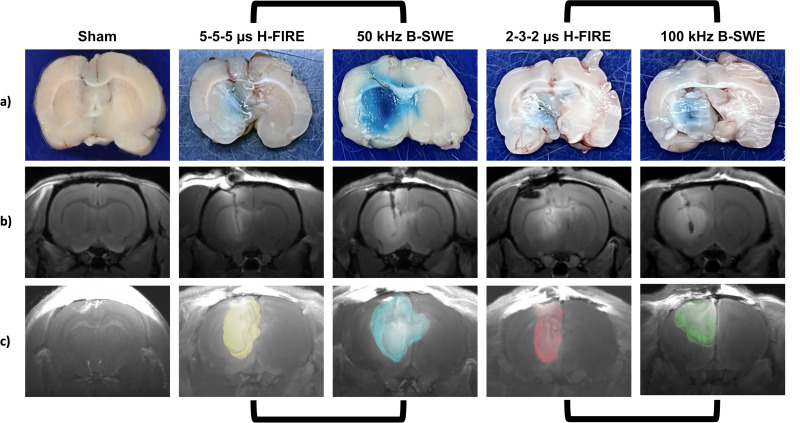 Burst sine wave electroporation (B-SWE) for expansive blood-brain barrier disruption and controlled non-thermal tissue ablation for neurological disease.