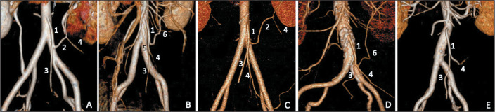 Evaluation of the mesenteric arterial vasculature by computed tomography angiography and its implications for colorectal cancer surgery.