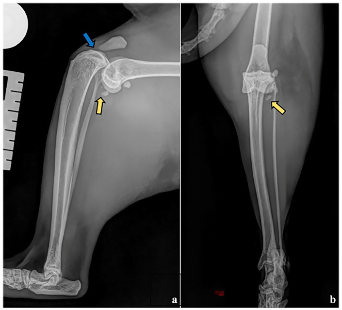 Combination of TPLO, medial and lateral augmentation techniques for the treatment of traumatic stifle luxation in a cat.