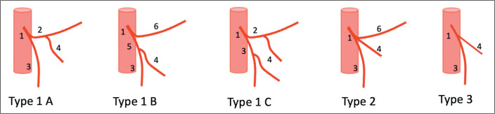 Evaluation of the mesenteric arterial vasculature by computed tomography angiography and its implications for colorectal cancer surgery.