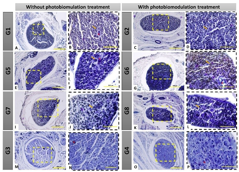 Delayed repair of the facial nerve and its negative impacts on nerve and muscle regeneration.