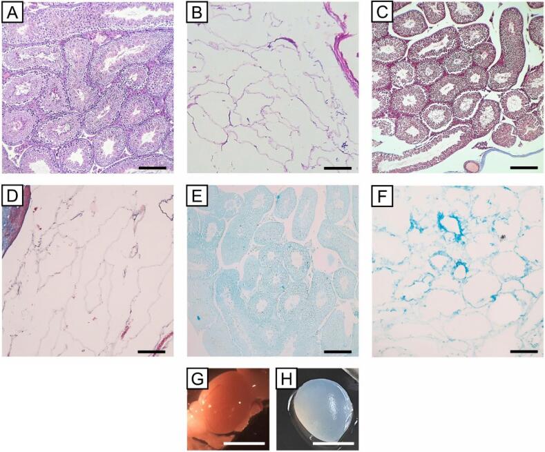 Retinoic acid-releasing scaffold based on chitosan hydrogel and testis decellular plates.