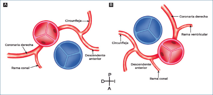 [Diagnosis and treatment in a series of patients with cardiac corrected transposition of the great arteries (double discordance)].