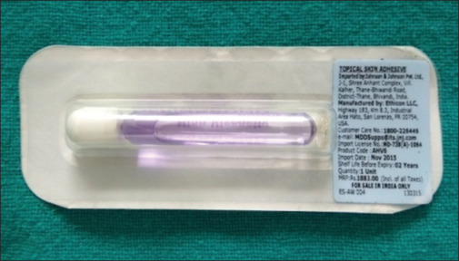 The surgical outcome of sutureless skin closures using Octyl-2-cyanoacrylate (Dermabond™) versus Steri-Strip™.