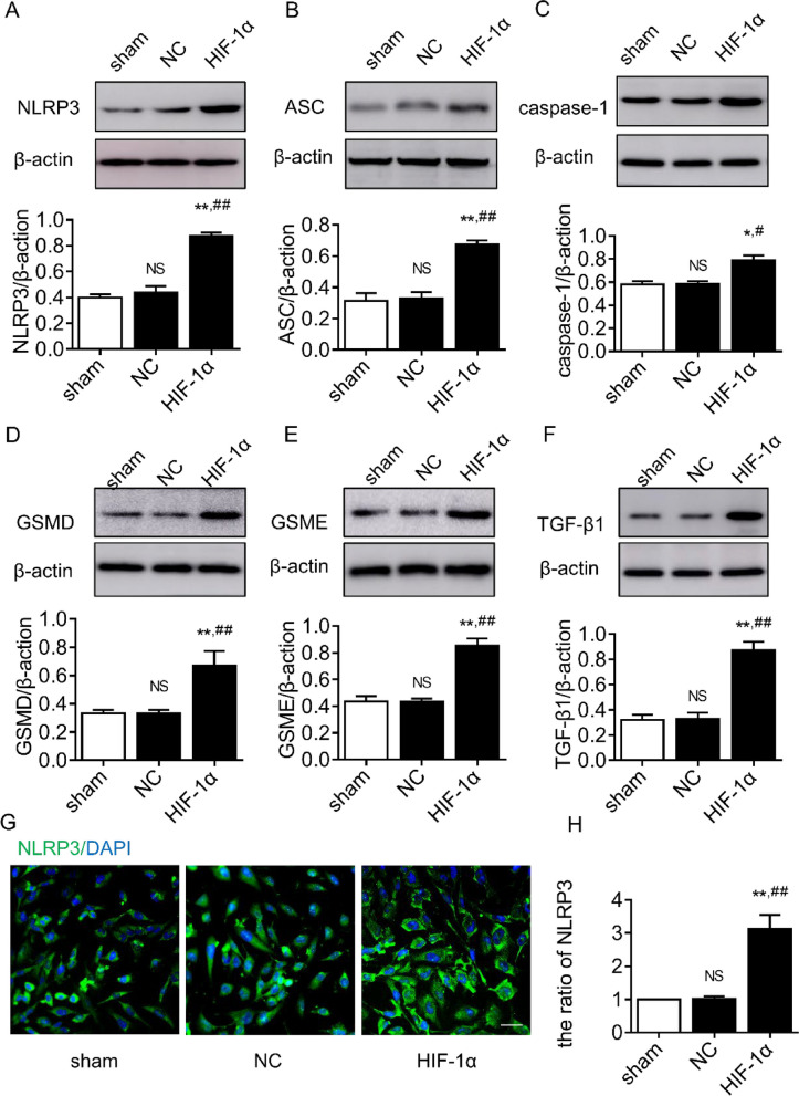 HIF-1α facilitates glioma proliferation and invasion by activating pyroptosis signaling axis.