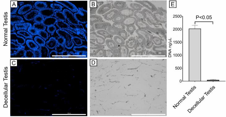 Retinoic acid-releasing scaffold based on chitosan hydrogel and testis decellular plates.
