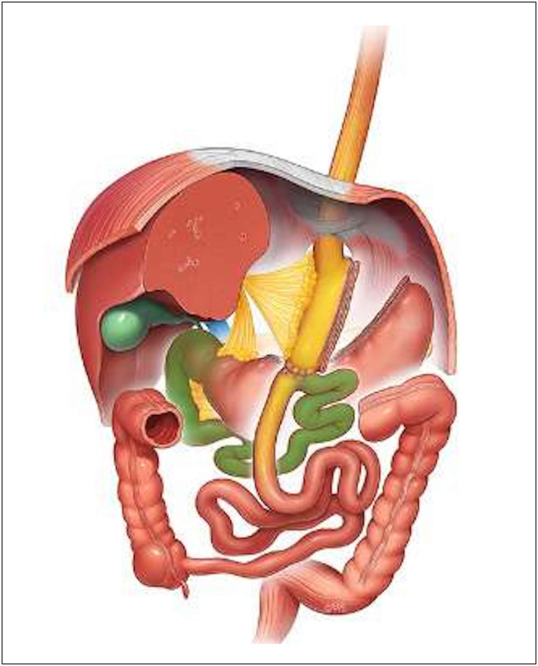 Effects of bariatric surgery on renal function: a retrospective cohort study comparing one-year outcomes between one-anastomosis gastric bypass and Roux-en-Y gastric bypass.