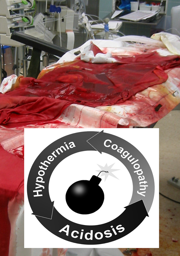 The pathophysiology of pelvic ring injuries: a review.