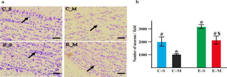 Investigating Olfactory Sensory Neurons Facilitation For Aerobic Exercise-induced Spatial Memory Improvement.