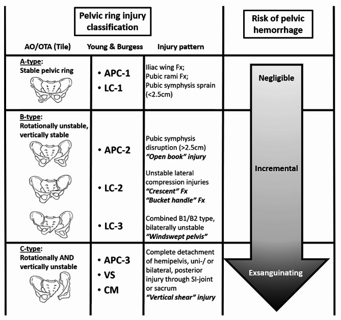 The pathophysiology of pelvic ring injuries: a review.