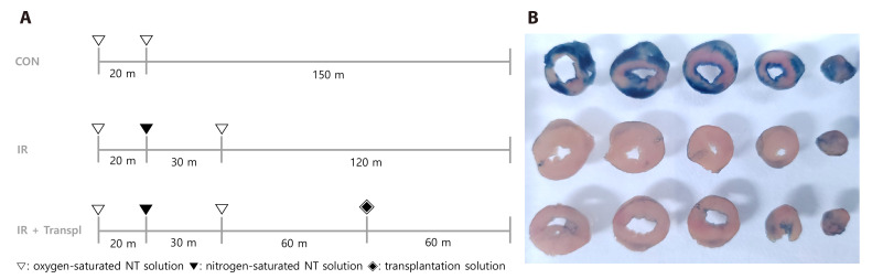 Cardioprotection <i>via</i> mitochondrial transplantation supports fatty acid metabolism in ischemia-reperfusion injured rat heart.