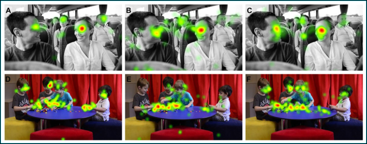Visual scanning of social stimuli in preterm and autism spectrum disorder children.
