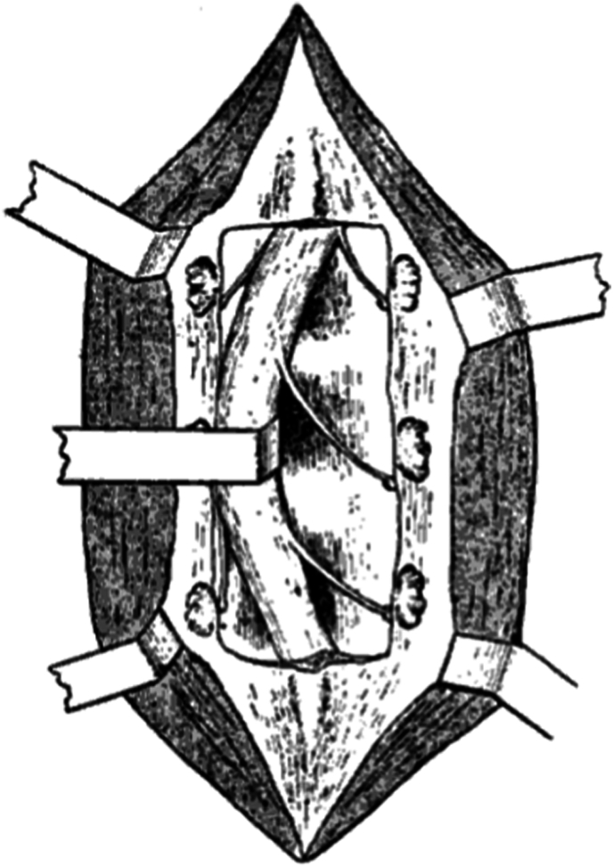 Abstract Image