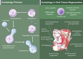 Autophagy, a double-edged sword for oral tissue regeneration