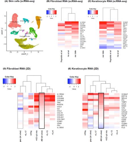 Single-cell RNA sequencing reveals 2D cytokine assay can model atopic dermatitis more accurately than immune-competent 3D setup