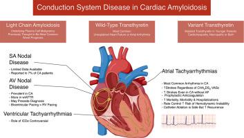 Conduction system disease in cardiac amyloidosis