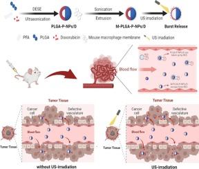 Stimuli-sensitive biomimetic nanoparticles for the inhibition of breast cancer recurrence and pulmonary metastasis