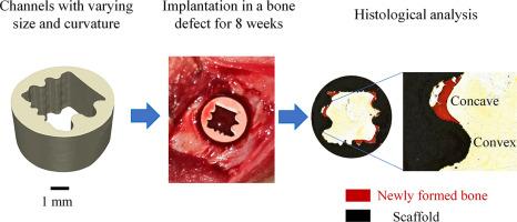 Unraveling the influence of channel size and shape in 3D printed ceramic scaffolds on osteogenesis