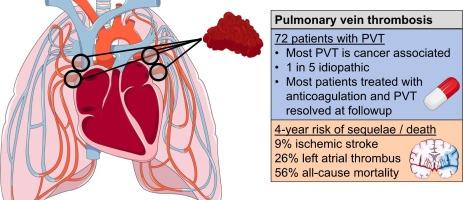 Pulmonary vein thrombosis: Clinical presentation and outcomes