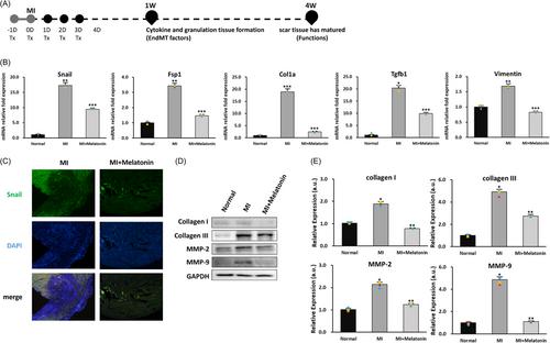 Melatonin alleviates myocardial dysfunction through inhibition of endothelial-to-mesenchymal transition via the NF-κB pathway