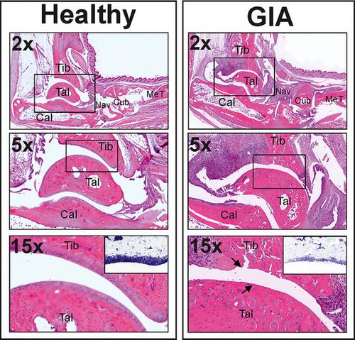 Recombinant Human Proteoglycan Aggrecan-G1 Domain-induced Arthritis (GIA) Mouse Model