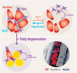 Fibro-adipogenic progenitors in physiological adipogenesis and intermuscular adipose tissue remodeling