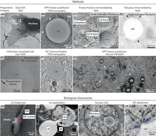 Zooming into lipid droplet biology through the lens of electron microscopy