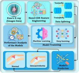 CDK: A novel high-performance transfer feature technique for early detection of osteoarthritis