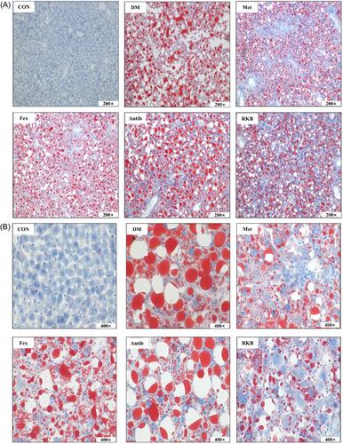 Research on the effects of intestinal FXR agonists and antibiotics on the regulation of red kidney bean polysaccharides in the liver metabolism in mice with type 2 diabetes