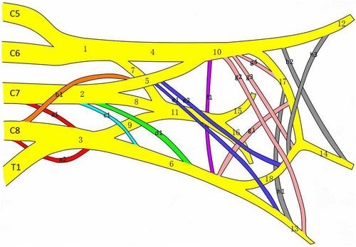 Anatomical variations of the brachial plexus in adult cadavers: A descriptive study and clinical significance