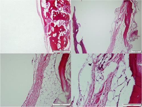 Comparing the effects of Bone+B® xenograft and InterOss® xenograft bone material on rabbit calvaria bone defect regeneration