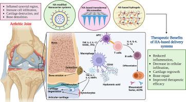 Bridging the gap in rheumatoid arthritis treatment with hyaluronic acid-based drug delivery approaches