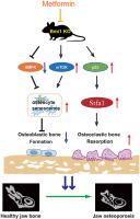 Metformin prevents mandibular bone loss in a mouse model of accelerated aging by correcting dysregulated AMPK-mTOR signaling and osteoclast differentiation