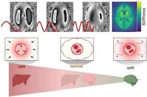 Magnetic resonance elastography in a nutshell: Tomographic imaging of soft tissue viscoelasticity for detecting and staging disease with a focus on inflammation