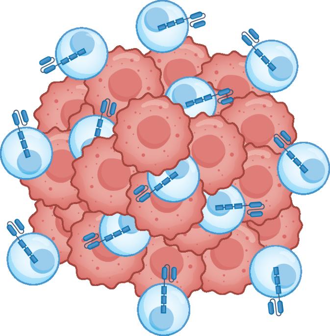 CAR T cells offer hope in glioblastoma