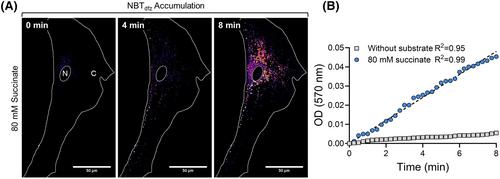 Heterogeneous distribution of mitochondria and succinate dehydrogenase activity in human airway smooth muscle cells