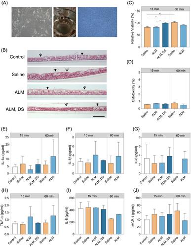 Safety evaluation of adenosine, lidocaine and magnesium (ALM) intranasal therapy toward human nasal epithelial cells in vitro