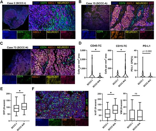 Multiomics sequencing and immune microenvironment characteristics define three subtypes of small cell neuroendocrine carcinoma of the cervix