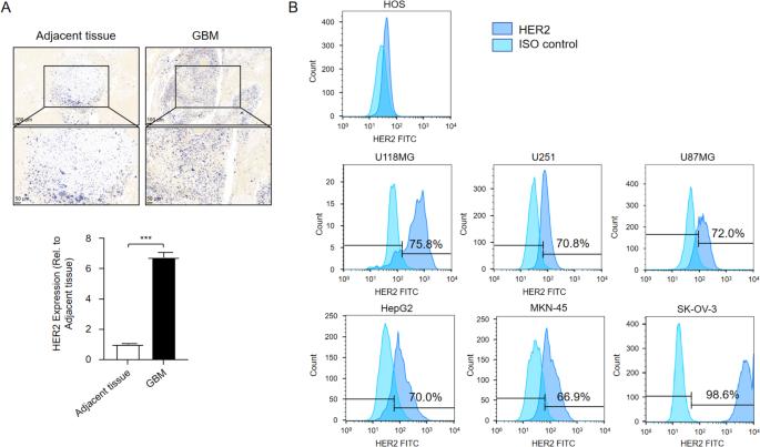 HER2-targeting CAR-T cells show highly efficient anti-tumor activity against glioblastoma both in vitro and in vivo