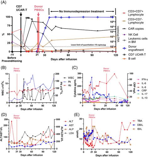 Stable engraftment, as well as graft versus host disease-free and relapse-free survival brought by the combination of CD7 targeted universal chimeric antigen receptor-T, and donor hemopoietic stem cells: Indication of a case report