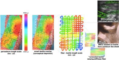 Interface tissues of the mesoderm: Periosteum, ligament, interosseous membrane, & myofascial tissues, an inspiration for next generation medical textiles