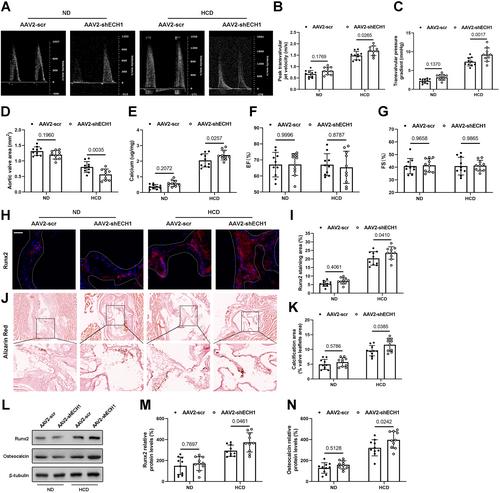 Enoyl coenzyme a hydratase 1 attenuates aortic valve calcification by suppressing Runx2 via Wnt5a/Ca2+ pathway