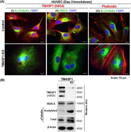 TM4SF1 is a molecular facilitator that distributes cargo proteins intracellularly in endothelial cells in support of blood vessel formation