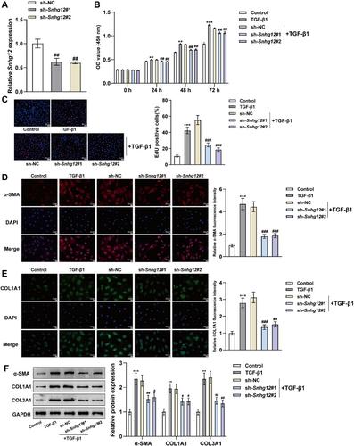 LncRNA Snhg12/IGFBP3 axis is involved in liver fibrosis by promoting the proliferation and activation of mouse hepatic stellate cells