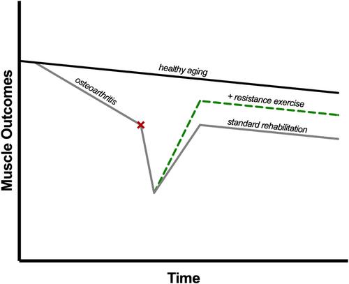 Resistance exercise training to improve post-operative rehabilitation in knee arthroplasty patients: A narrative review