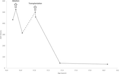 Screening and surveillance of hepatocellular carcinoma by serum des-gamma-carboxy prothrombin in patients with glycogen storage disease type Ia