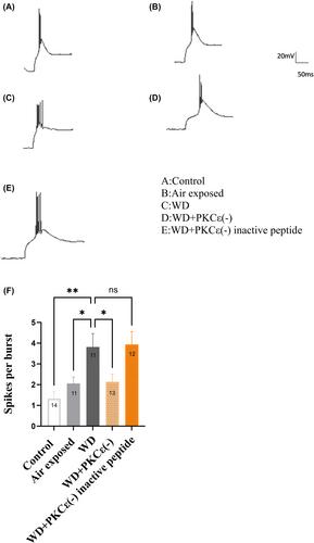 Protein kinase C epsilon-mediated modulation of T-type calcium channels underlies alcohol withdrawal hyperexcitability in the midline thalamus