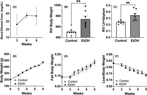 Ethanol-induced lung and cardiac right ventricular inflammation and remodeling underlie progression to pulmonary arterial hypertension