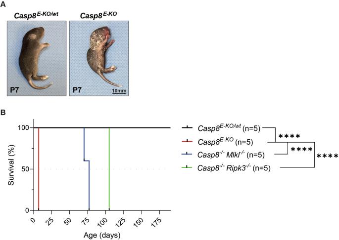 The importance of murine phospho-MLKL-S345 in situ detection for necroptosis assessment in vivo