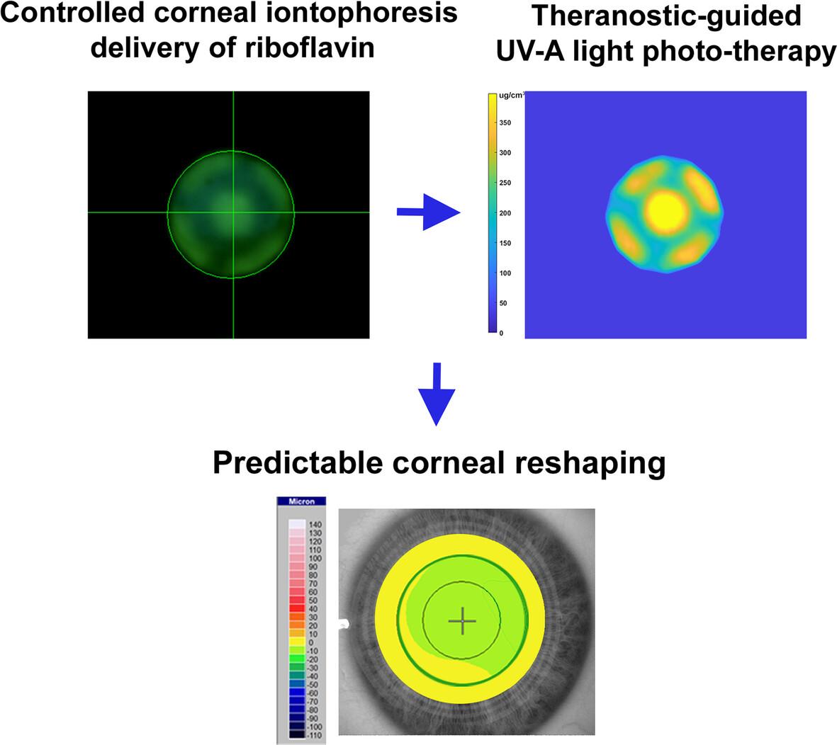 Spatial targeted delivery of riboflavin with a controlled corneal iontophoresis delivery system in theranostic-guided UV-A light photo-therapy